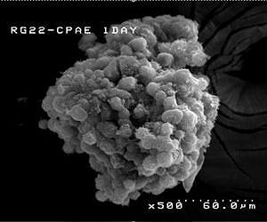 First targeted and programmable nanomedicine to show clinical antitumor effects published