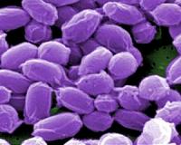 Boy dies, dozens hospitalised in far northern Russian anthrax outbreak