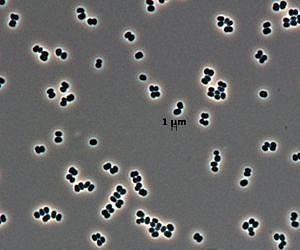 Rare New Microbe Found in Two Distant Clean Rooms