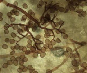 Tapid detection and identification of downy mildew in basil
