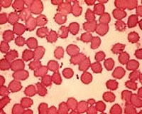 Precautions after scientist's plague death