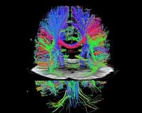 Medical millirobots offer hope for less-invasive surgeries