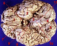 Brain Scans Reveal What's Behind The Aversion To Loss Of Possessions