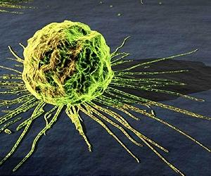 Many chemicals unproven to raise breast cancer risk