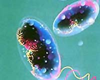 Death toll rises to 28 in Mozambique cholera epidemic