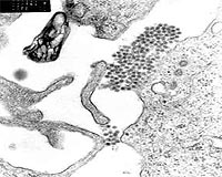 Weather helps predict dengue fever
