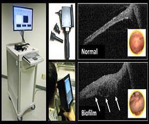 New device sees bacteria behind the eardrum