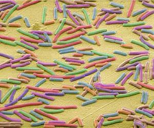 How infectious disease may have shaped human origins