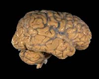 Origins Of The Brain