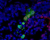 New stem cell may overcome hurdles for regenerative medicine