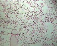 Spray application of respiratory cells holds promise for tissue engineering