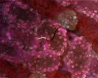 Carbohydrates may be the key to a better malaria vaccine