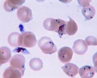 Cause of malaria drug resistance in SE Asia identified