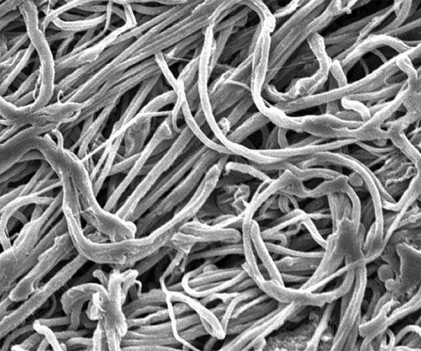 Ultrafine particles linked to deaths: Canada study