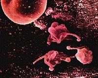 New superbug resistant to last-line antibiotics: study