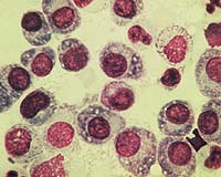 Novel On-Off Switch Mechanism Stops Cancer In Its Tracks