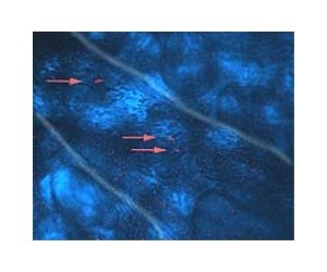 Blood Vessel Cells Key To Growing Unlimited Amounts Of Adult Stem Cells
