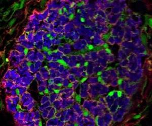 Team creates genetic GPS system to comprehensively locate and track inhibitory nerve cells
