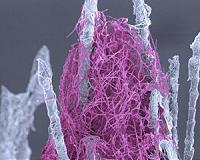 Scientists identify tissue-degrading enzyme in white-nose syndrome