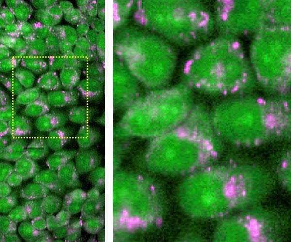 Technology development could bring Raman microscopy to the clinic