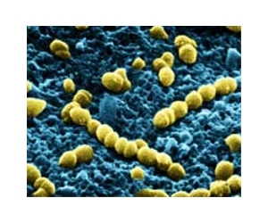 How zinc starves lethal bacteria to stop infection