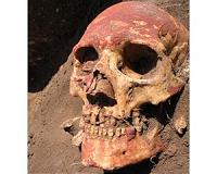 Plague in humans 'twice as old' but didn't begin as flea-borne, ancient DNA reveals